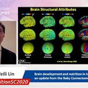 Brain development and nutrition in toddlers –update from the Baby Connectome Project Prof. Weili Lin