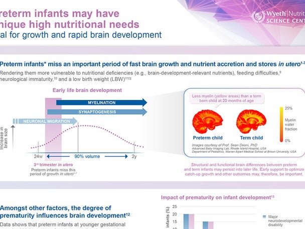 Preterm infants have unique nutritional needs vital for brain development
