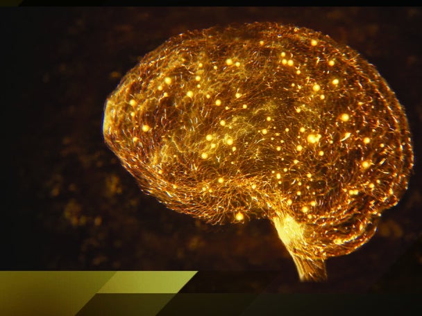 From Diet to Cognition